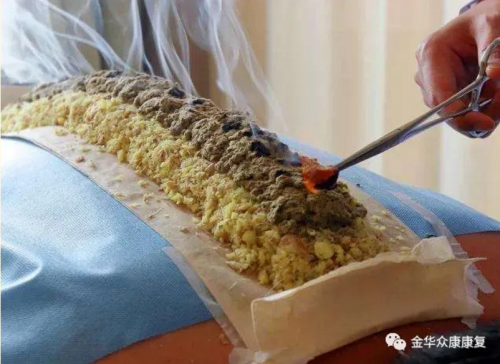 督脈灸的操作過程及適應人群