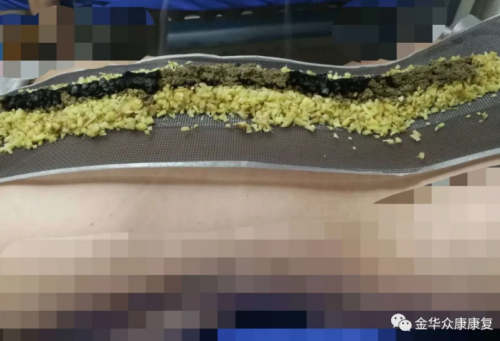 督脈穴位相對應的疾病治療