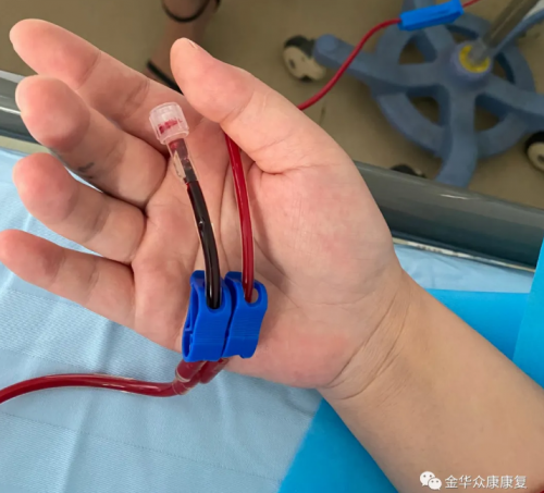 金華眾康醫(yī)院引進(jìn)特色療法：三氧自血療法！