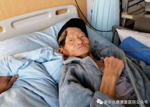 康復在線：額顳術后重新站起來的奇跡不再是神話